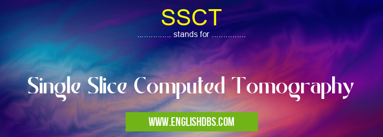 SSCT