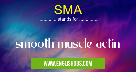 SMA